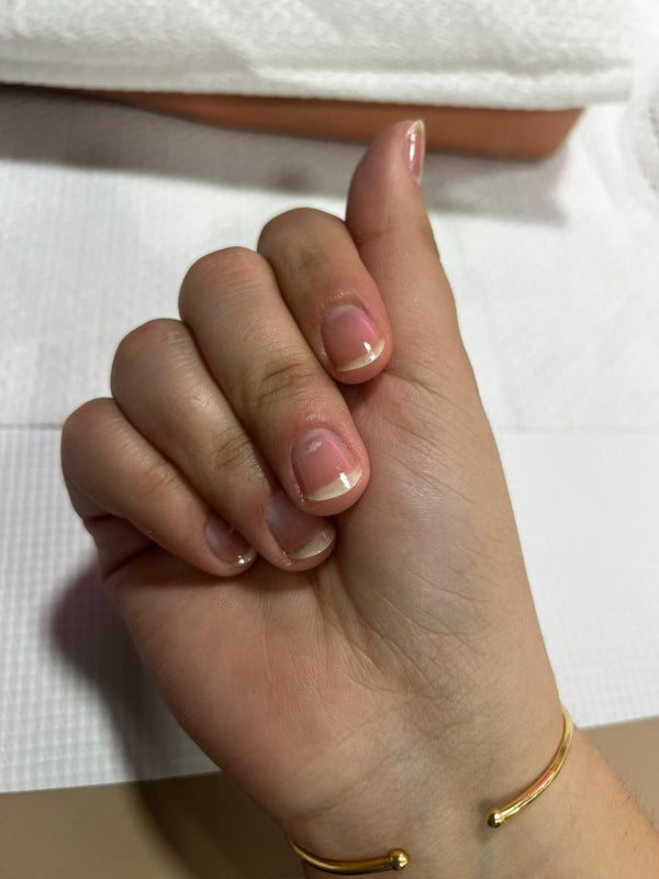 After