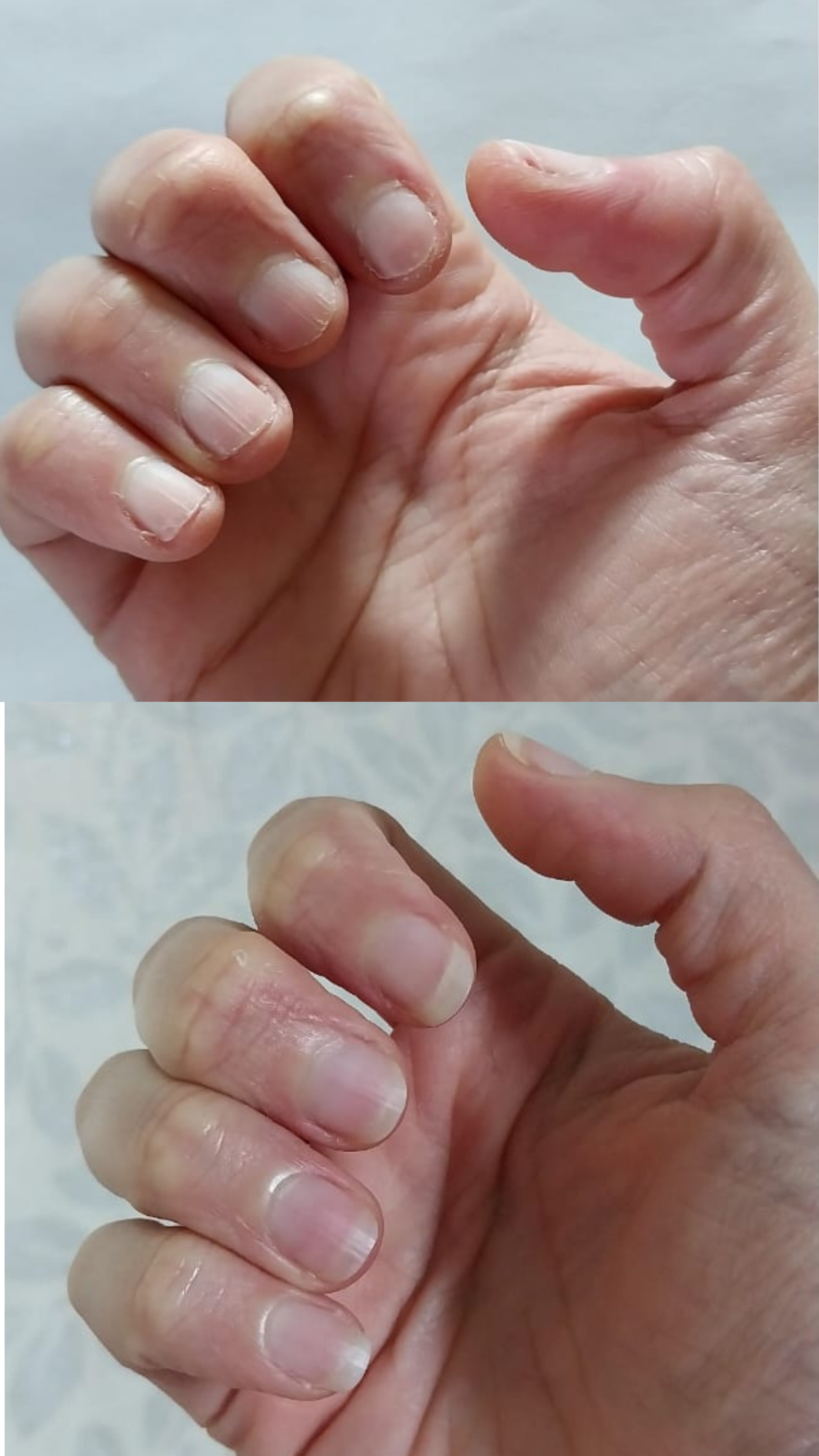 L’ANTIDOTE – Nail Regeneration Oil