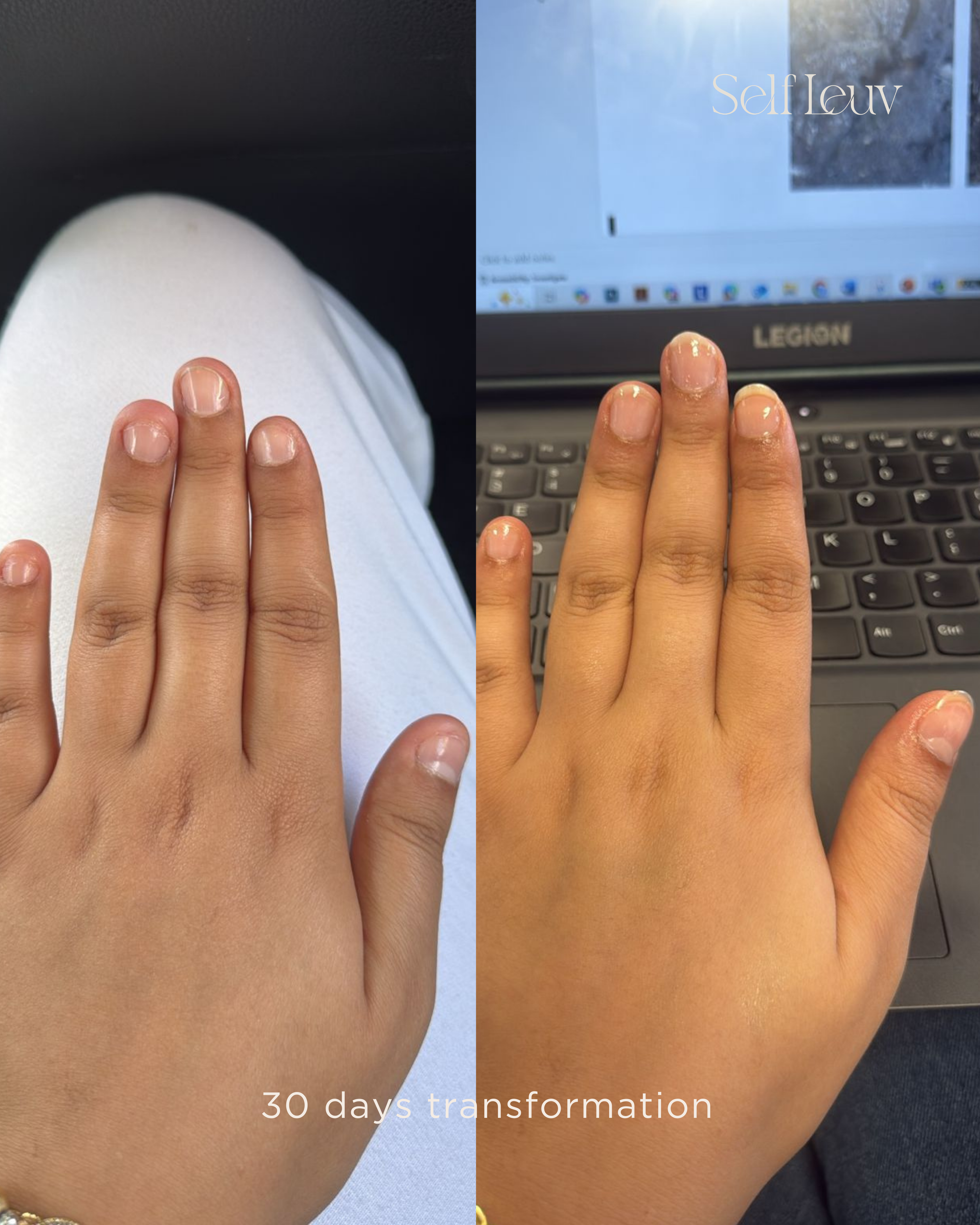 The Essential Nail Biting Ritual