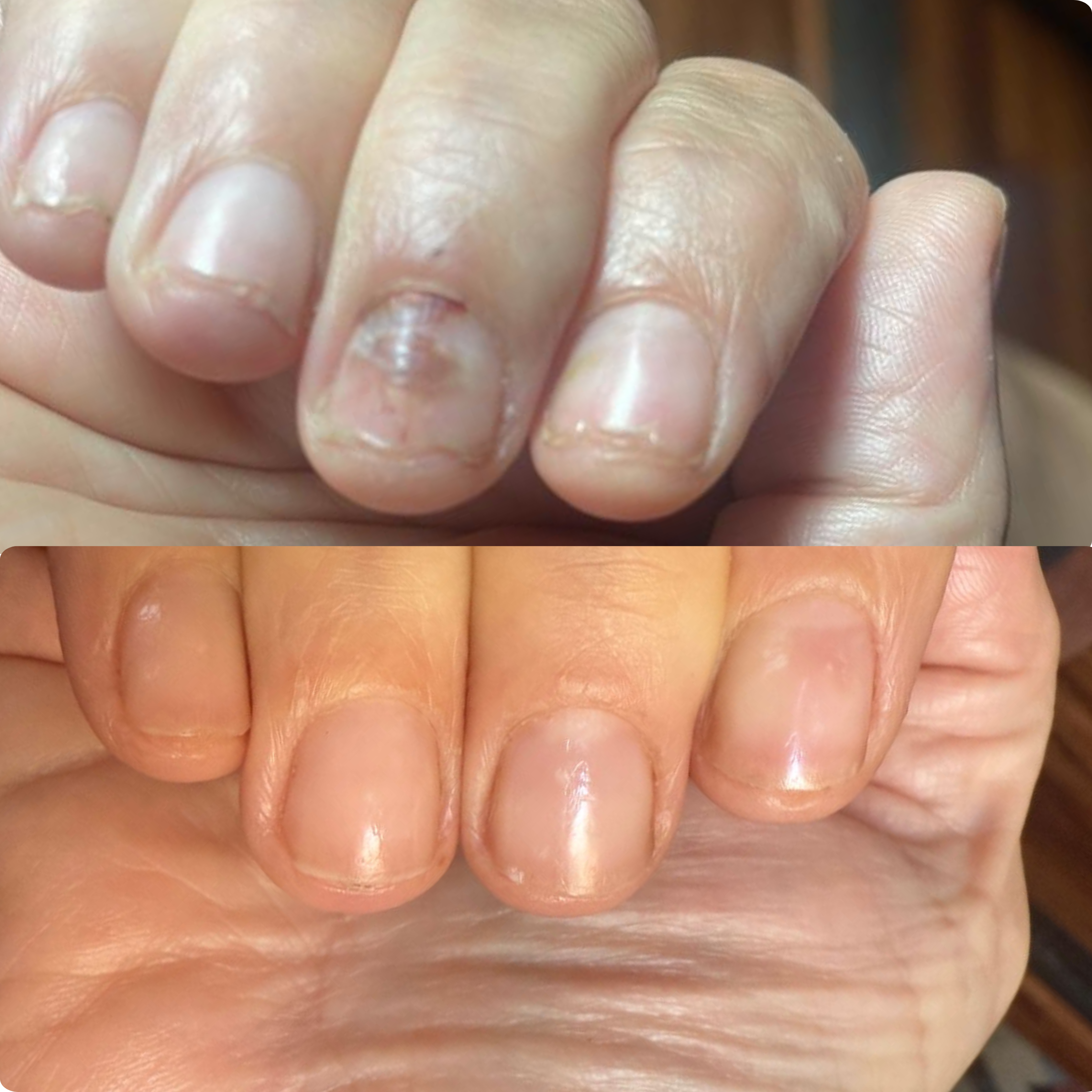 The Nail Ritual