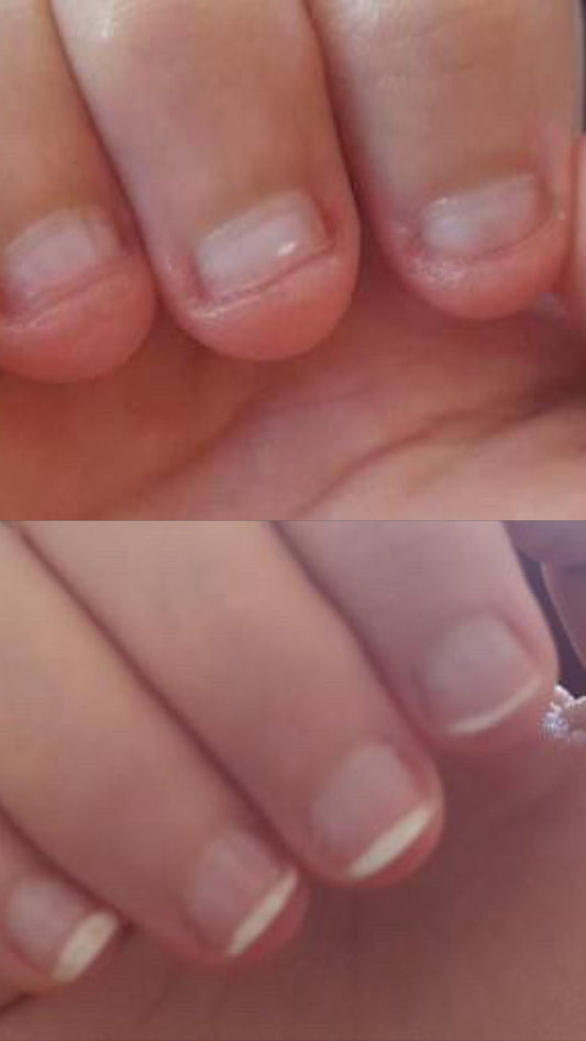 The Essential Nail Biting Ritual