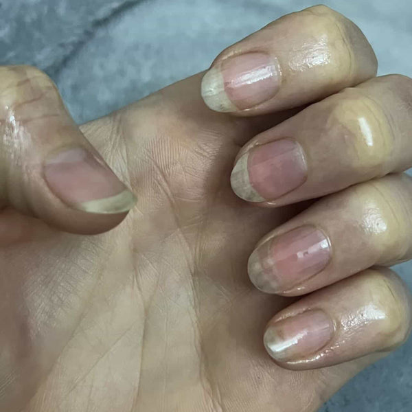 After