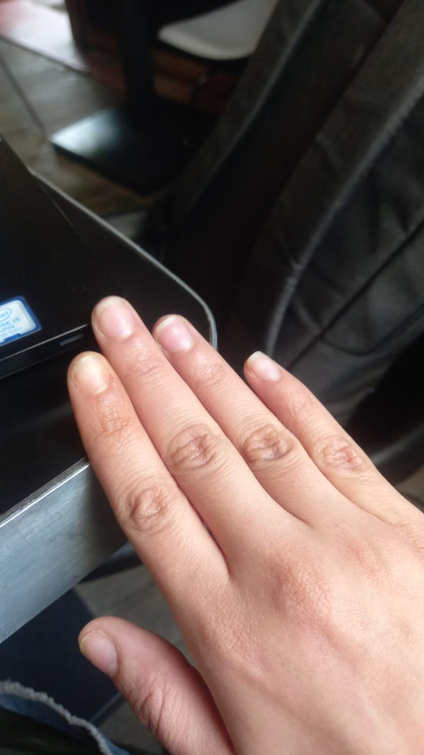 After