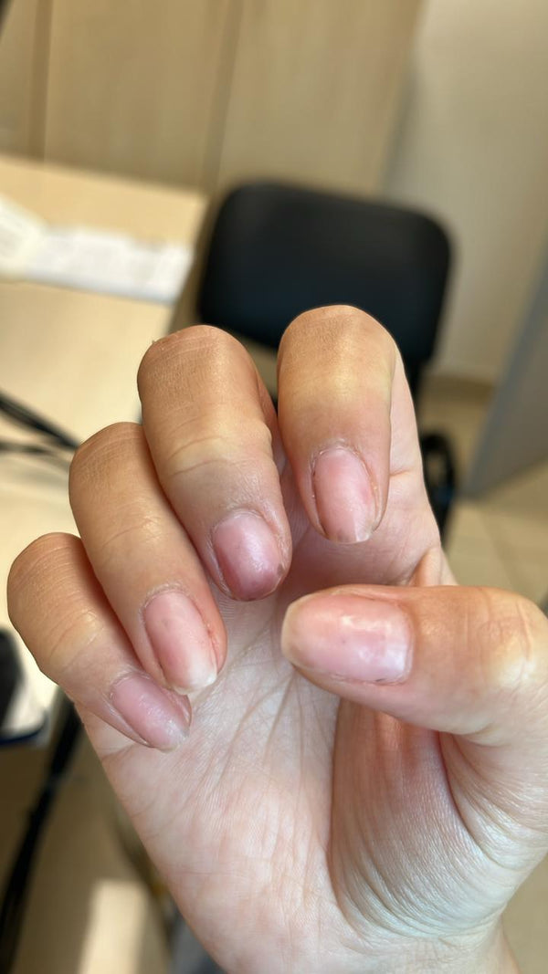 Before