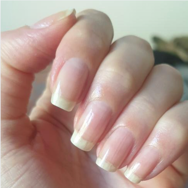 After