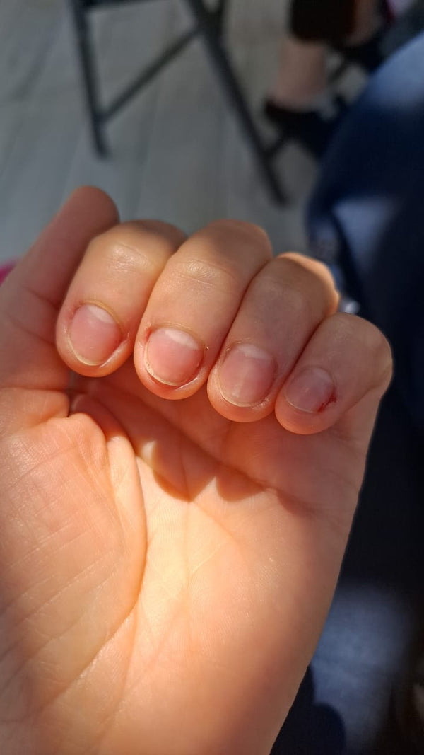 After