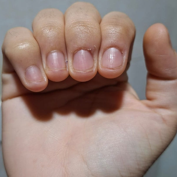 Before