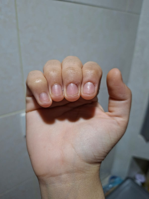 Before
