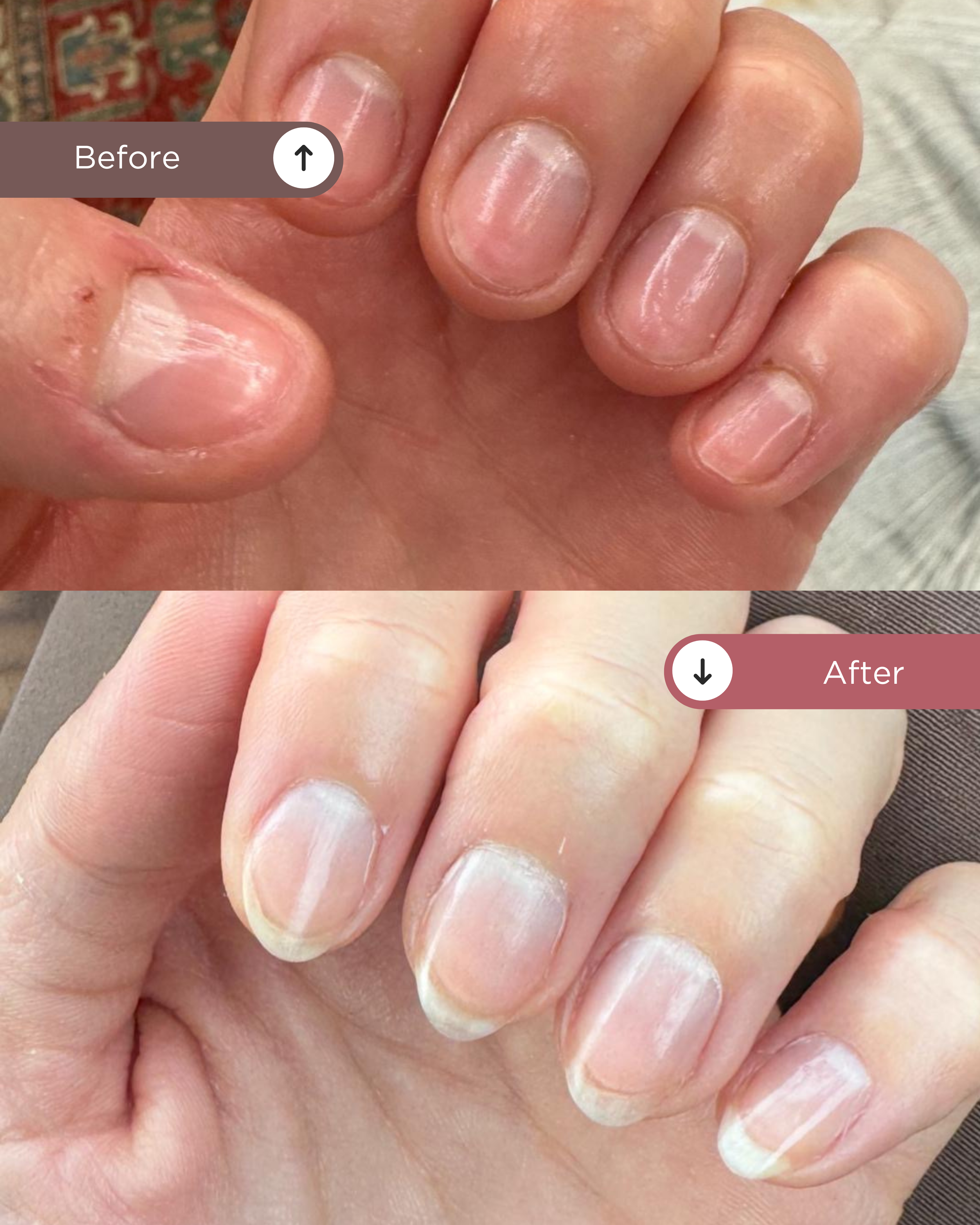 The Full Eczema Healing Ritual