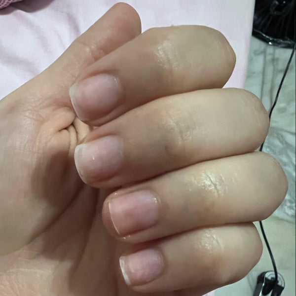 Before