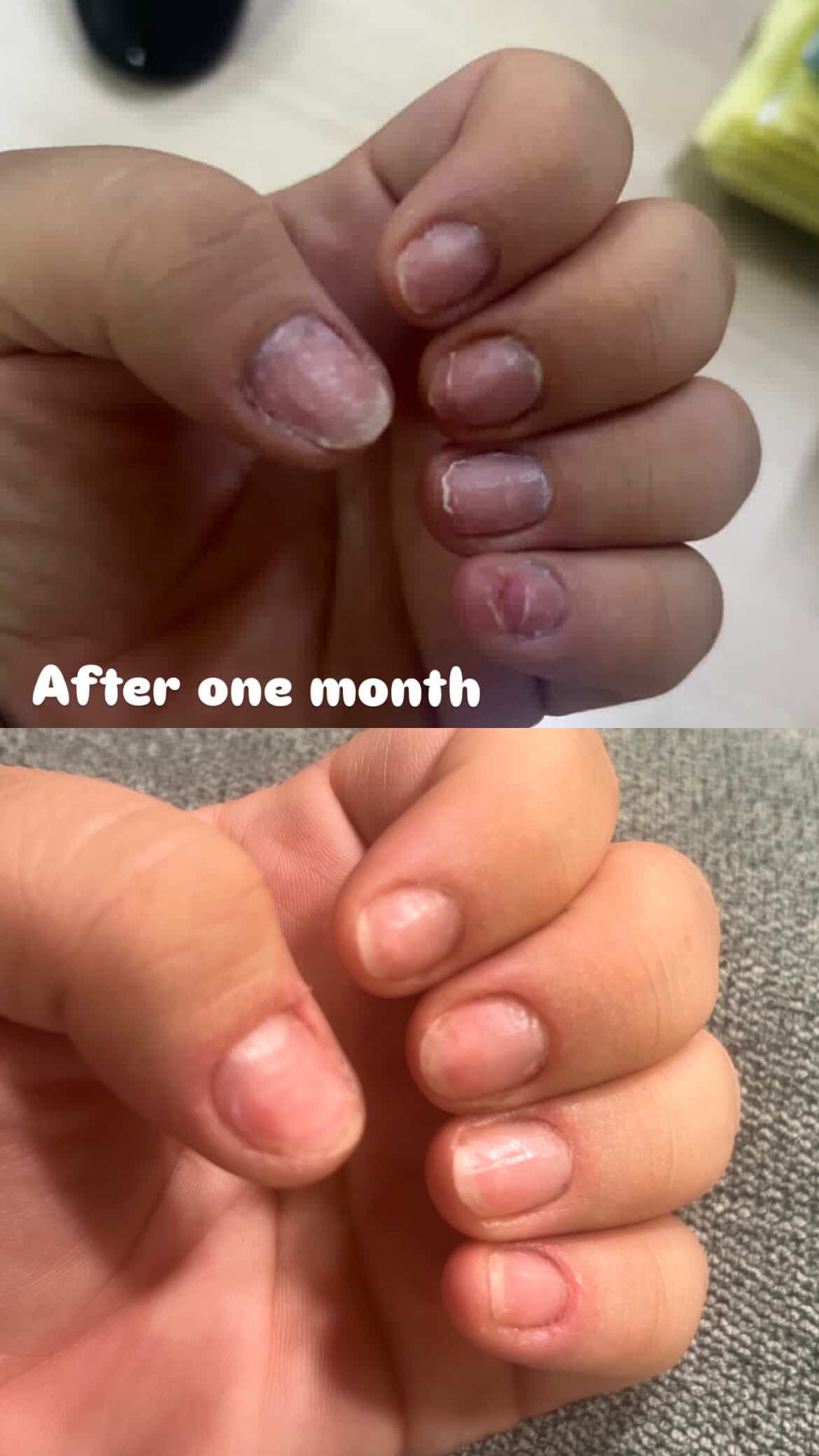 L’ANTIDOTE – Nail Regeneration Oil