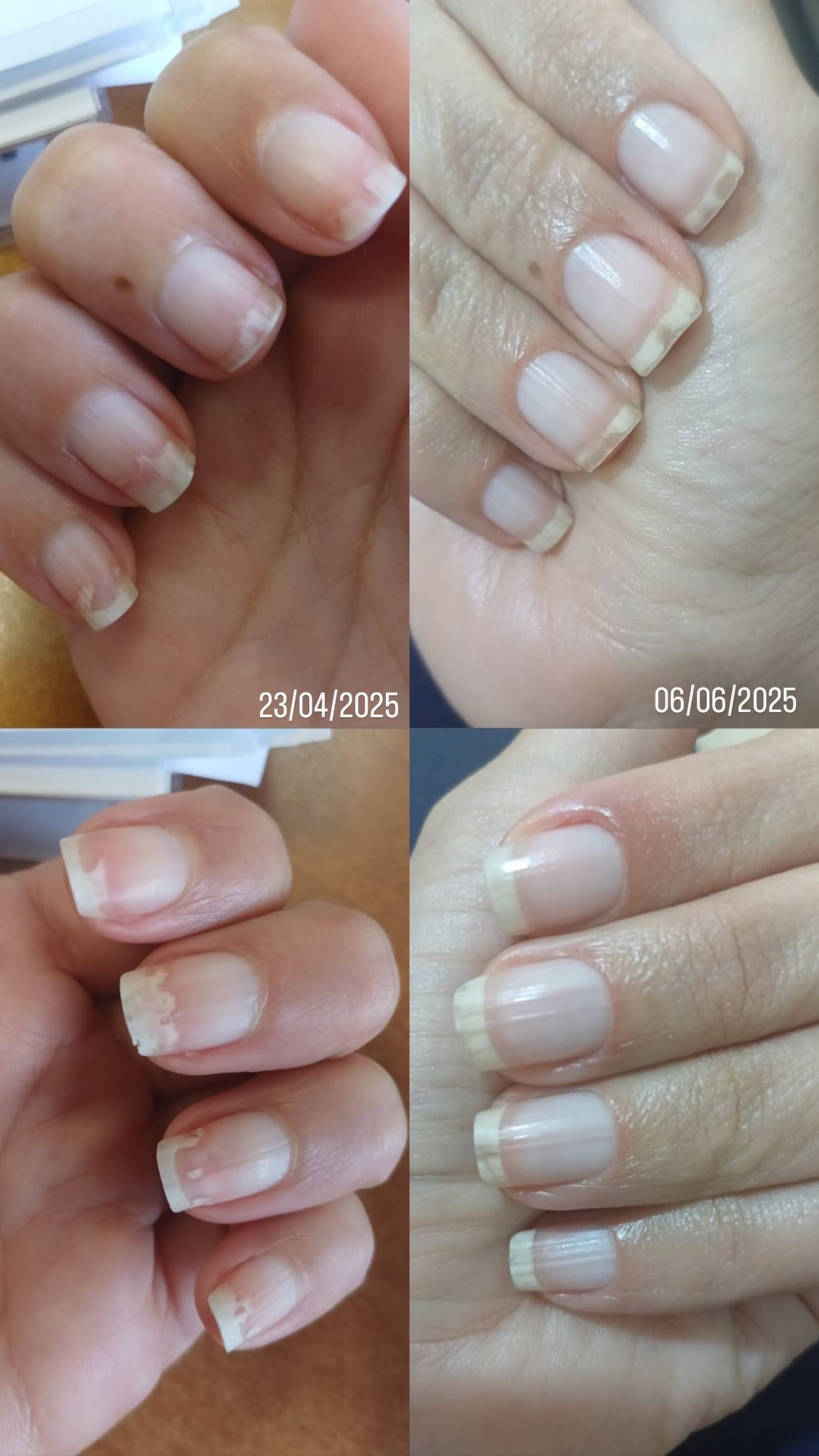 LE REMÈDE – The Antifungal Nail Restoration Oil